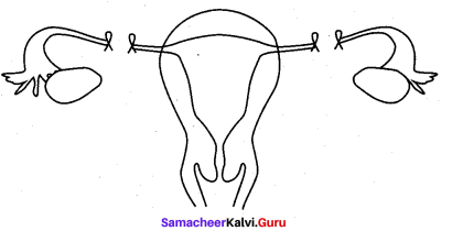 Samacheer Kalvi 12th Bio Zoology Solutions Chapter 3 Reproductive Health